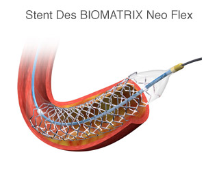 Stent Biomatrix Neo Flex
